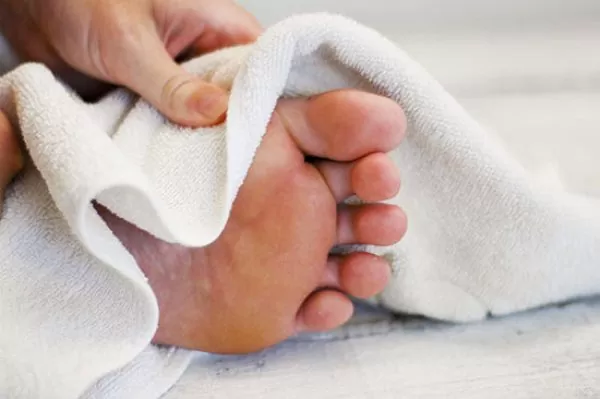 athlete foot due to towel hygiene
